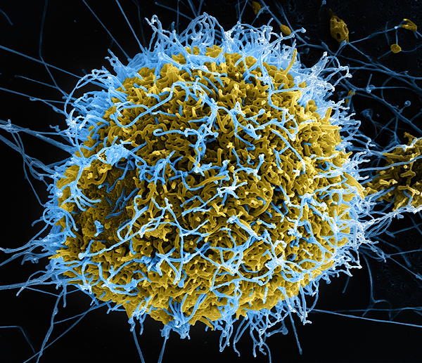 Ebolavirus